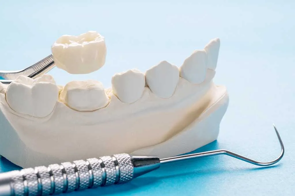 Crown model