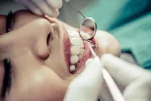 Dentist providing a resin tooth restoration