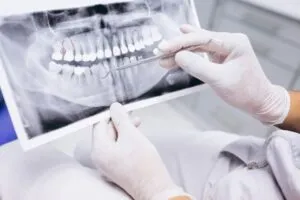 Dental X-ray showing the teeth and jaw