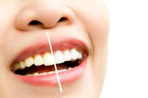Learn about teeth whitening in Brookfield, WI